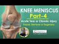 Knee Meniscus Part 4 - Acute Tear or Chronic Injury? Repair? Remove? or Regenexx?
