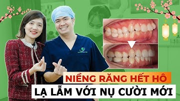 Không Chấp Nhận Nổi Răng Cũ , Mình Đã Quyết Định Đi Niềng Răng