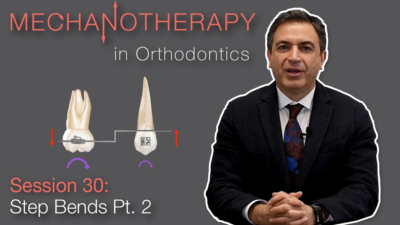 Mechanotherapy in Orthodontics: Step Bends Pt. 2