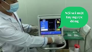 Nội soi mật tuỵ ngược dòng tại bệnh viện quân y 110