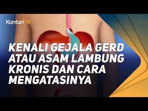 Video: Cara Mendiagnosis Refluks Asid: 15 Langkah (dengan Gambar)