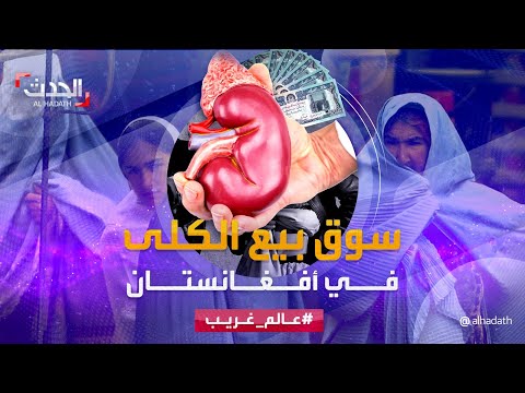 عالم غريب سوق لبيع الكلى في أفغانستان دون رقيب أو حسيب
