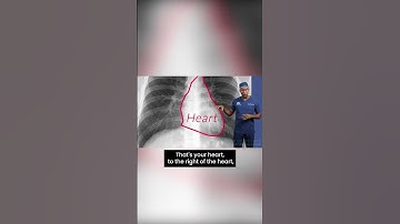 How to read a CHEST X-RAY, let