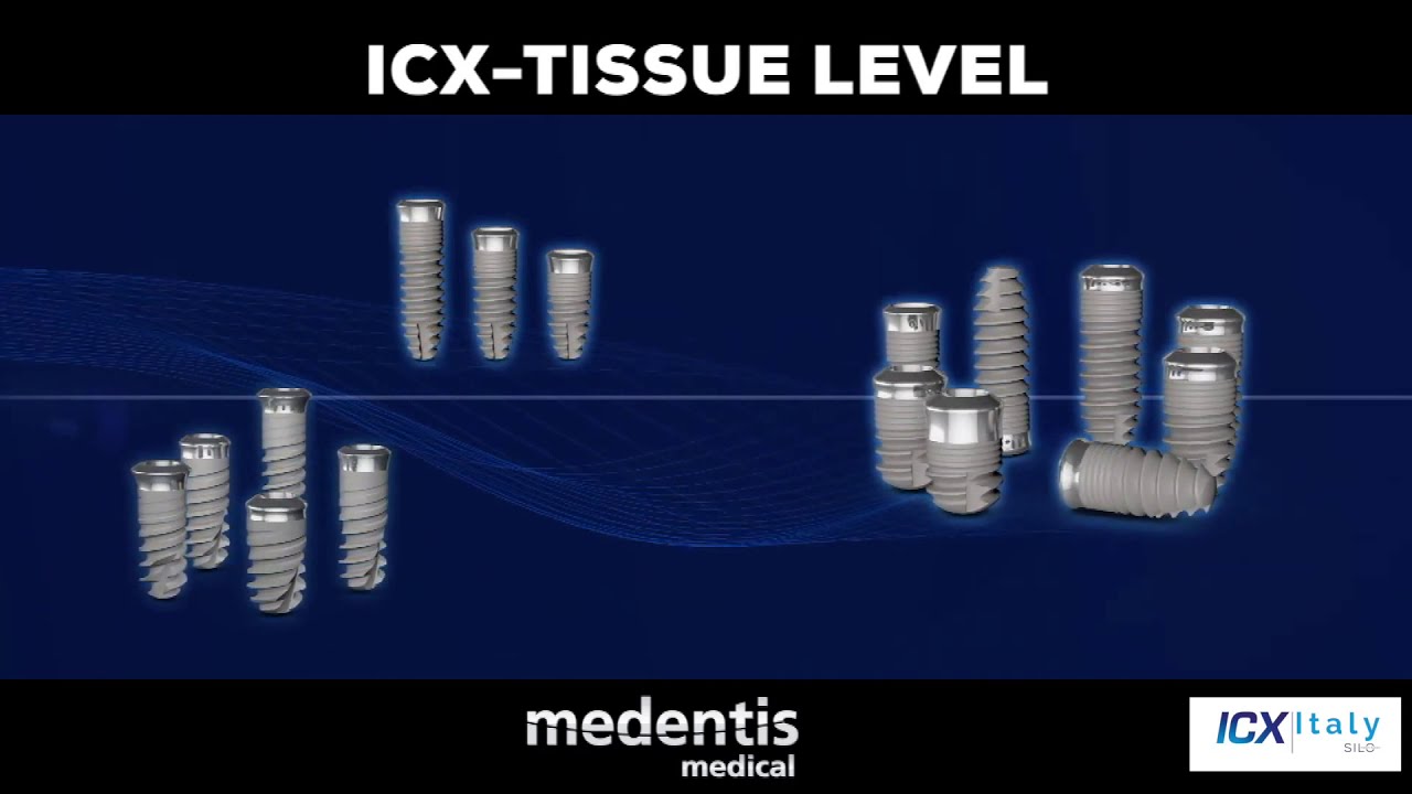 Silo Implant System presenta gli impianti ICX