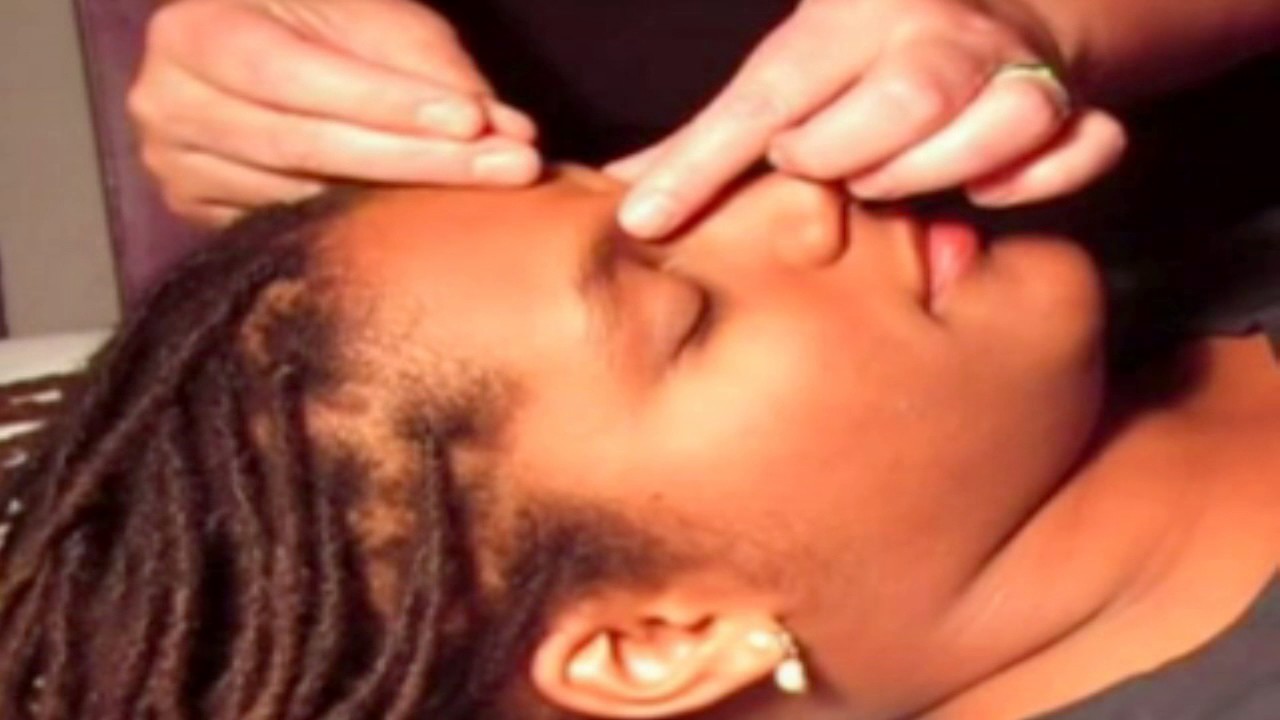 Acupuncture Treatment - Archive Stock Footage