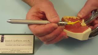Periodontal Charting Explained
