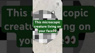This Microscopic Creature Living On Your Face