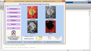 Matlab Code for Ulcer Detection Using Image Processing IEEE Based Project