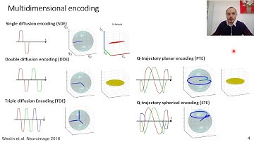 Focus on Q-Space Trajectory Imaging (QTI) - part1