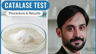 Catalase Test | Procedure of Catalase Test