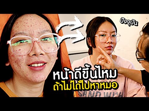 หน้าพัง ไปหาหมอไม่ได้ รักษายังไง