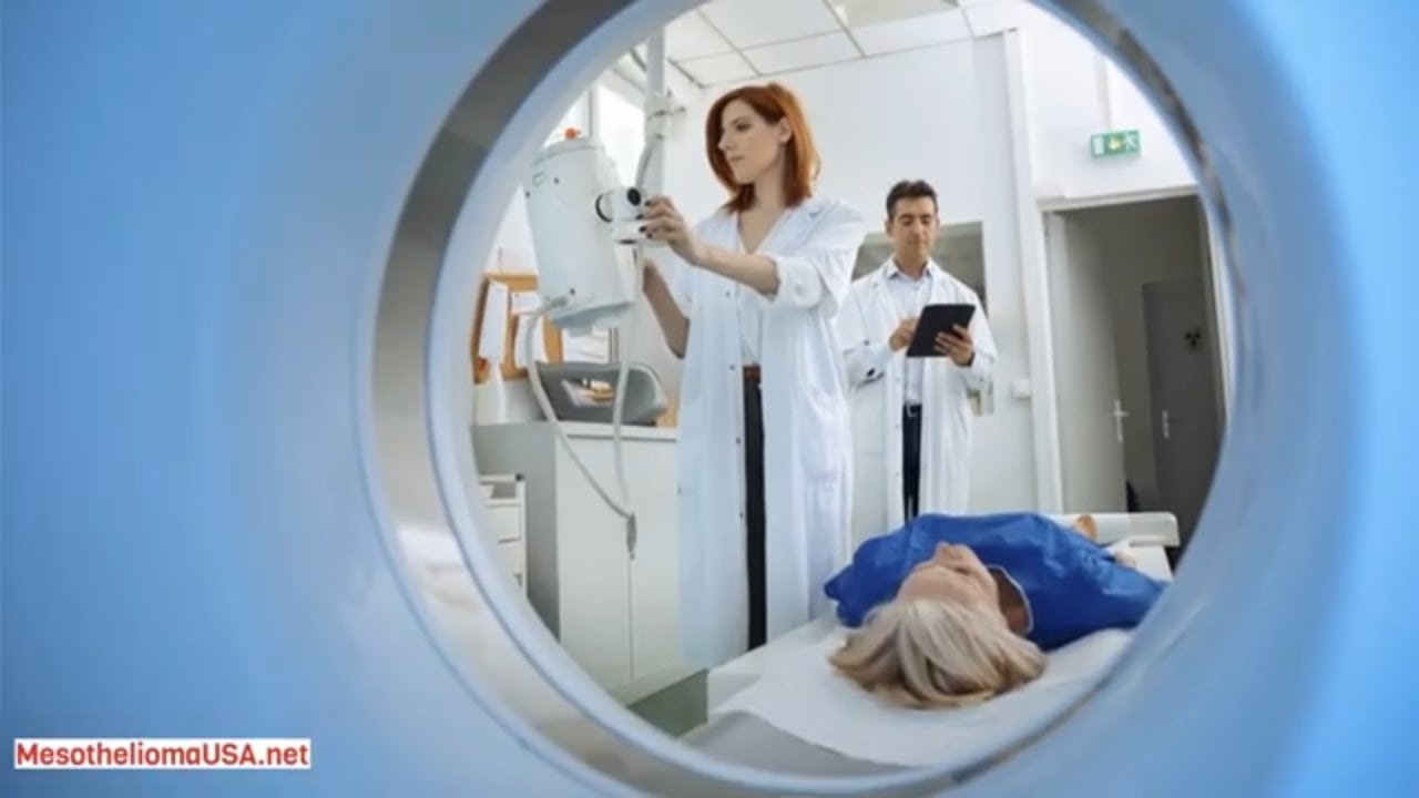5 YEAR SURVIVAL MESOTHELIOMA - MESOTHELIOMA PROGNOSIS