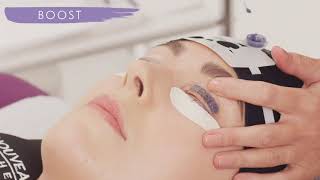 What To Expect During A LVL Treatment
