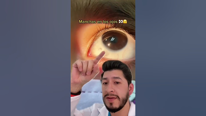 Esto significa tu mancha en tus ojos 👀🫣