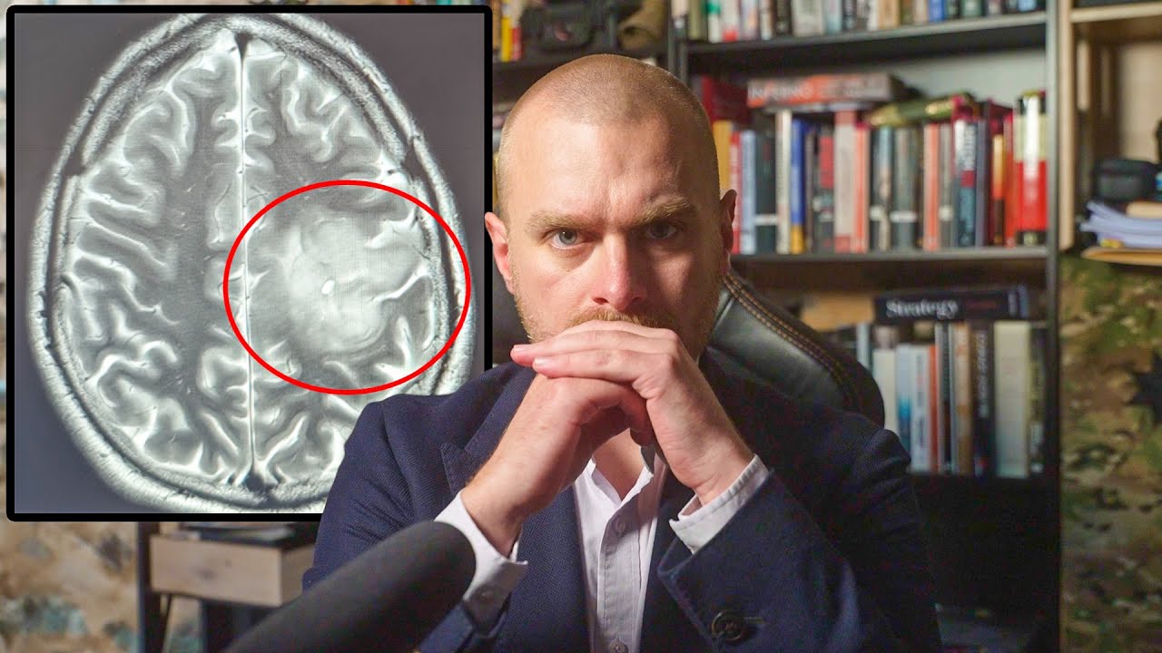 Наконец-то всё кончено, конец химиотерапии и результаты МРТ опухоли головного мозга | Что дальше?