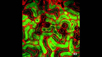 Reduction of Tubular Flow Rate as a Mechanism of Oliguria in the Early Phase of Endotoxemia...