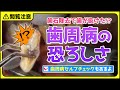 歯周病の最終形態!歯石除去すら出来ません😭