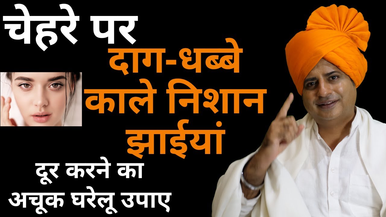 चेहरे पर दाग काले धब्बे निशान साफ़ करने का अचूक उपाय, Fair and Glowing