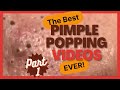 The best pimple poppings ever p1