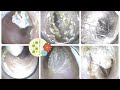 【耳そうじ】Vol.30 耳掃除6連発!日本橋カレイドスコープ earwax removal Tokyo earspa Kaleidscope