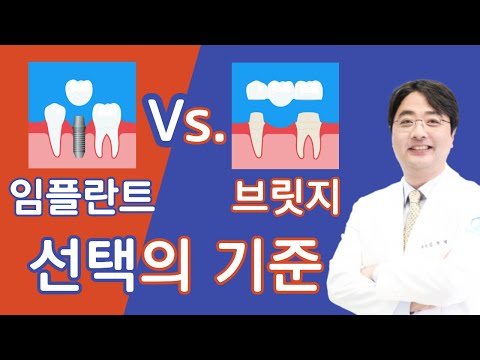 임플란트 가격