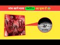 मांस खाने वाला Becteria आ चुका हैं 😨 || Flesh Eating Becteria || #steptococcasbecteria #syndrome