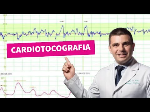 Vídeo: Onde colocar ctg?