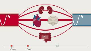 Critical Insights - Shock Management