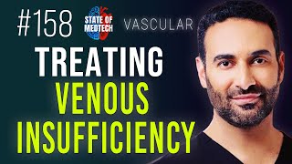 Treating Venous Insufficiency in a New Way with Ali Golshan MD screenshot 4