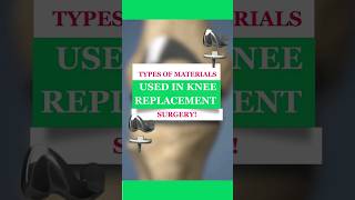 Types of materials used in Knee Replacement surgery | Dr. Amite Pankaj Aggarwal #kneereplacement