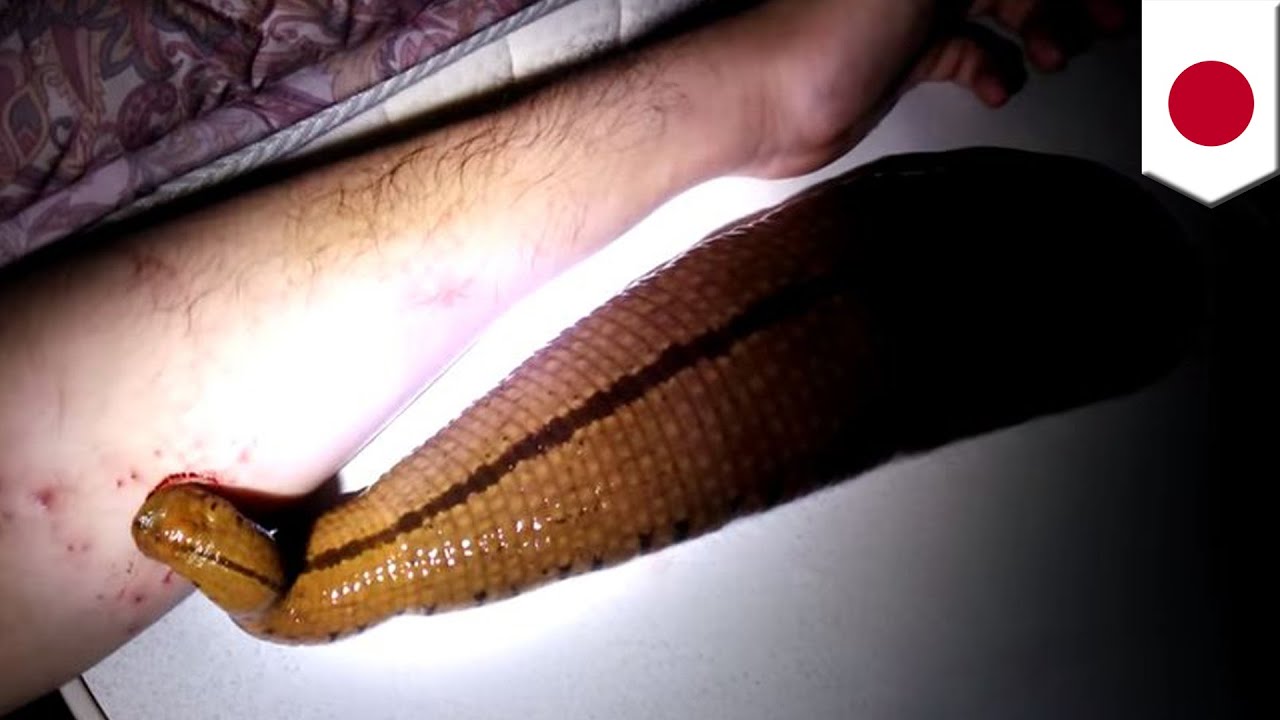 Giant pet leech: Owner gives parasitic pet its daily dose of blood straight  from his arm 