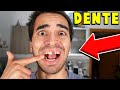 MI SI  ROTTO UN DENTE!!