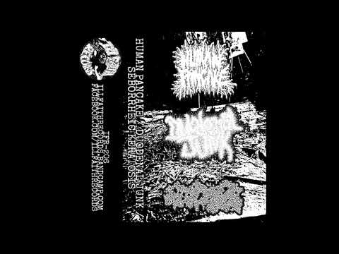 Duodenal Junk- Disembodied 3-Way Split @brandondenetsosie8718