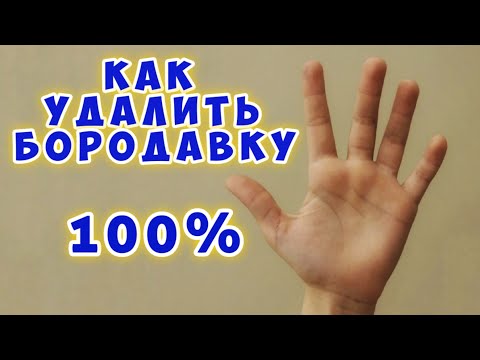 Как удалить бородавку - Я знаю способ 100