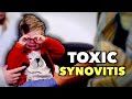 HE HAS TOXIC SYNOVITIS! (What to Know & How to Spot It in Kids) | Dr. Paul