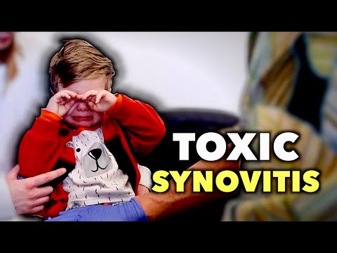 HE HAS TOXIC SYNOVITIS! (What to Know & How to Spot It in Kids) | Dr. Paul