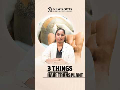 3 Reasons You’re Not Ready for Hair Transplant in Bangalore ⚠️ #hairtransplant #shorts