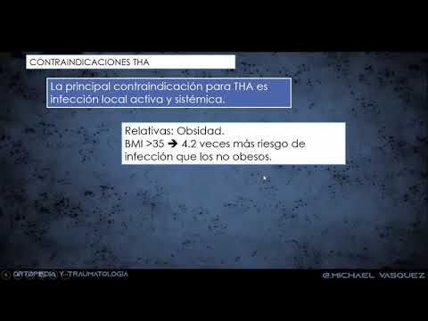 Vídeo: Actualizaciones Recientes Para Biomateriales Utilizados En Artroplastia Total De Cadera