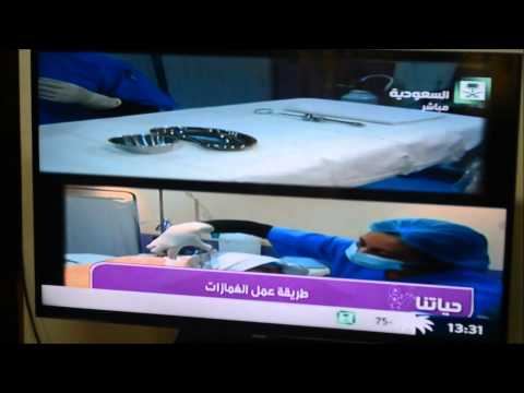  1 الدكتور عمرو عبدالله استشاري جراحات التجميل وكيفية عمل الغمازة عيادات سدك العليا الرياض
