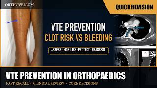 VTE Prevention in Orthopaedics — Thrombosis Risk Versus Bleeding — Quick Revision (clinical review)