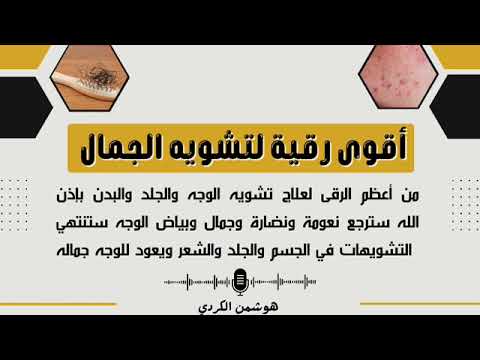 اقوى رقية لتشويه الجمال الراقي هوشمن الكردي