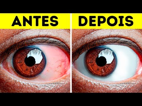 Vídeo: Como Fazer Seus Olhos Parecerem Menos Cansados e Inchados