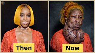 Top 10 Black Celebs With The WORST Plastic Surgery: The Unbelievable Cost of Fame!