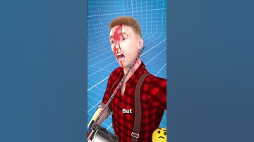 Thumbnail of How Chainsaw Kickback Works😬