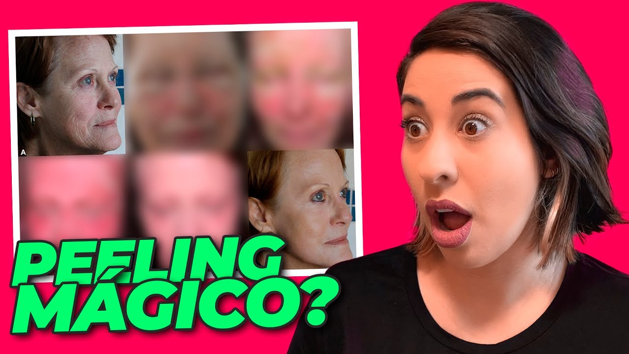 PEELING DE FENOL É SEGURO? O QUE A CIÊNCIA FALA SOBRE ISSO? • Física e Afins