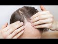 Hairstylist Explains Hair Loss - TheSalonGuy