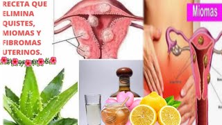 ¿Qué planta sirve para eliminar quistes en los ovarios?
