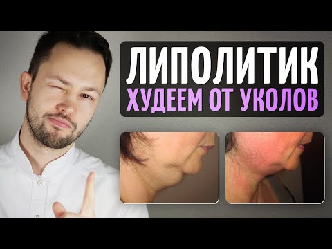 Как похудеть от уколов. Липолитики.