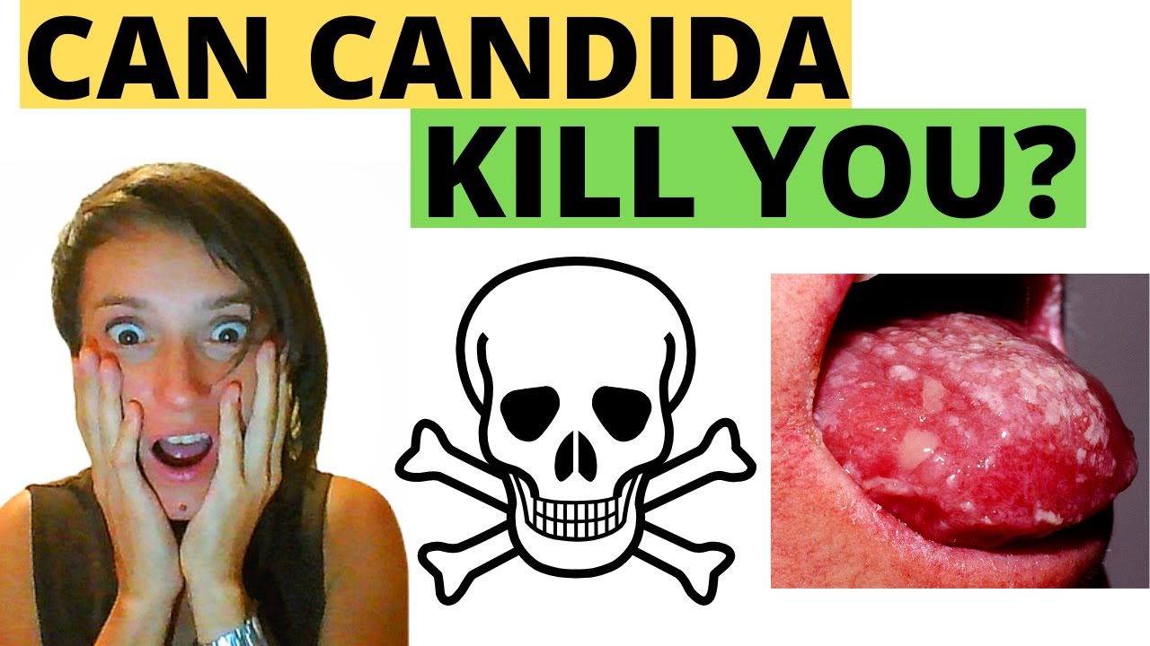 Systemic Candida Infection Symptoms, Risks, Solutions YouTube