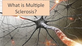 What is Multiple Sclerosis (MS)?